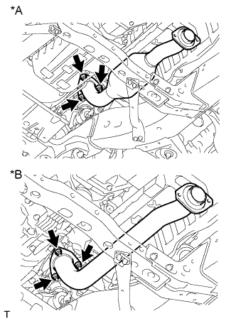 A01DMT5E01