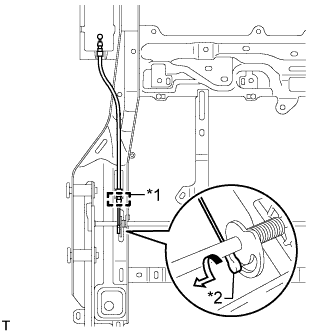 A01DN11E01