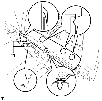 A01DPSLE01