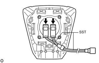 A01XACPE01