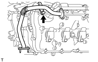 A01XBBL