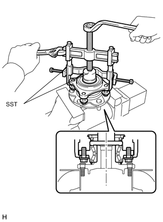 A01XKNEE01