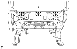 A01XL52