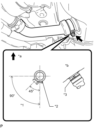 A01CXNOC01