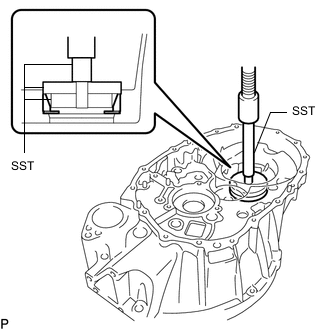 A01GBRYN01