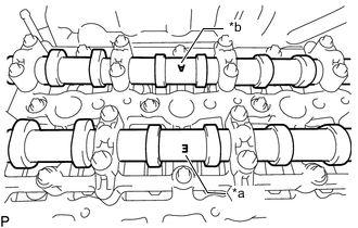 A01TBMMC01