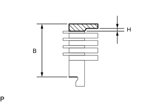 A01LBFTN01