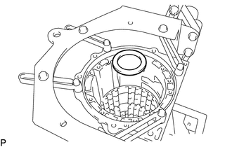 A01LFA4